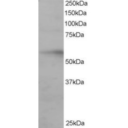 Interferon Regulatory Factor 6 (IRF6) Antibody