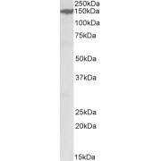 abx431988 (0.3 µg/ml) staining of Rat Kidney lysate (35 µg protein in RIPA buffer). Primary incubation was 1 hour. Detected by chemiluminescence.