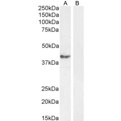 Calcipressin-1 (RCAN1) Antibody