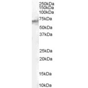 Western blot analysis of Human Spleen lysate (35 µg protein in RIPA buffer) using Signal Transducing Adaptor Molecule 2 (STAM2) Antibody (1 µg/ml, 1 hour).