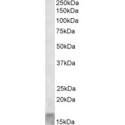 abx432004 (0.1 µg/ml) staining of Human Skeletal Muscle lysate (35 µg protein in RIPA buffer). Primary incubation was 1 hour. Detected by chemiluminescence.