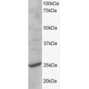 abx432005 staining (1 µg/ml) of human liver lysate (RIPA buffer, 35 µg total protein per lane). Primary incubated for 1 hour. Detected by western blot using chemiluminescence.