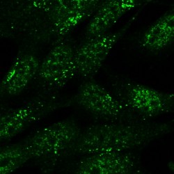 Sorting Nexin 1 (SNX1) Antibody