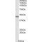 Uracil Nucleotide/Cysteinyl Leukotriene Receptor (GPR17) Antibody