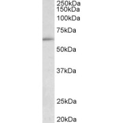 abx432033 (0.1 µg/ml) staining of HepG2 lysate (35 µg protein in RIPA buffer). Primary incubation was 1 hour. Detected by chemiluminescence.
