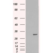 HEK293 overexpressing Human STX6 and probed with abx432036 (mock transfection in first lane). abx432036 (0.3 µg/ml) staining of human lymph node lysate (35 µg protein in RIPA buffer). Primary incubation was 1 hour. Detected by chemiluminescence.