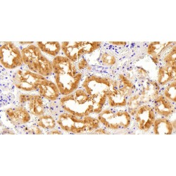 Aldehyde Reductase Antibody