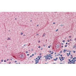 Solute Carrier Family 22 Member 17 (SLC22A17) Antibody