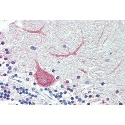 Tripartite Motif Containing 71 (TRIM71) Antibody