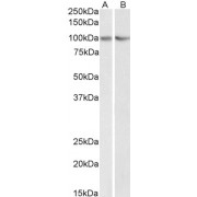 abx432050 (0.3 µg/ml) staining of HEK293 (A) and NIH3T3 (B) lysate (35 µg protein in RIPA buffer). Primary incubation was 1 hour. Detected by chemiluminescence.