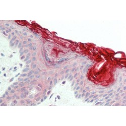 p53 Apoptosis Effector Related To PMP-22 (PERP) Antibody