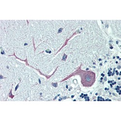 Oxysterol-Binding Protein-Related Protein 1 (ORP1) Antibody