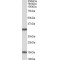 NAD-Dependent Protein Deacetylase Sirtuin-3, Mitochondrial (SIRT3) Antibody