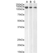 Western blot analysis of extracts of HeLa (A), HepG2 (B) and Jurkat (C) lysate (35 µg protein in RIPA buffer) using DDB1 antibody (1 µg/ml).