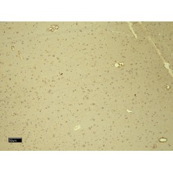 Damage Specific DNA Binding Protein 1 (DDB1) Antibody