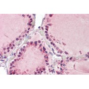 abx432080 (3.75 µg/ml staining of paraffin embedded Human Thyroid. Steamed antigen retrieval with citrate buffer pH 6, AP-staining.