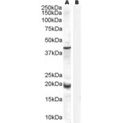 abx432092 (0.3 µg/ml) staining of Human Prostate lysate (35 µg protein in RIPA buffer) with (B) and without (A) blocking with the immunising peptide. Primary incubation was 1 hour. Detected by chemiluminescence.