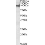 Western blot analysis of Mouse Heart lysate (35 µg protein in RIPA buffer) using Plakophilin 2 Antibody (0.3 µg/ml). Detected by chemiluminescence.