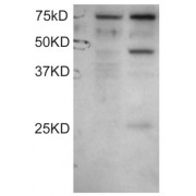 Western blot analysis of extract of COS1 lysates: untransfected (left lane) and transfected with full length recombinant Human DYX1C1 (right lane) using DYX1C1 antibody (0.1 µg/ml).