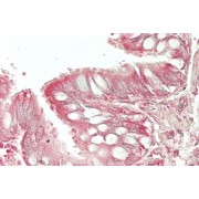 abx432102 (5 µg/ml staining of paraffin embedded Human Lung. Steamed antigen retrieval with citrate buffer pH 6, AP-staining.