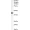 F-Box Protein 32 (FBXO32) Antibody