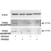 abx432105 (0.5 µg/ml) staining of Rat VSMC lysate (35 µg protein in RIPA buffer). Primary incubation was overnight at 4C. Detected by chemiluminescence.