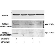 abx432106 (0.5 µg/ml) staining of Rat VSMC lysate (35 µg protein in RIPA buffer). Primary incubation was overnight at 4C. Detected by chemiluminescence.