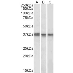 DNA Polymerase Delta Interacting Protein 2 (POLDIP2) Antibody