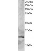 abx432118 staining (2 µg/ml) of Human Heart lysate (RIPA buffer, 35 µg total protein per lane). Primary incubated for 1 hour. Detected by western blot using chemiluminescence.