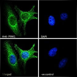 Serine/Threonine-Protein Kinase PINK1, Mitochondrial (PINK1) Antibody