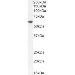 Pre-mRNA Processing Factor 31 (PRPF31) Antibody