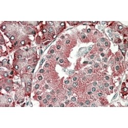 Protein Disulfide Isomerase A2 (PDIA2) Antibody