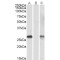 DPY30 Domain-Containing Protein 1 (DYDC1) Antibody