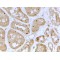 Nucleolar And Coiled-Body Phosphoprotein 1 (NOLC1) Antibody