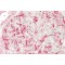 Unc-51 Like Kinase 3 (Ulk3) Antibody