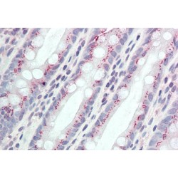 Coiled-Coil Domain Containing 3 (CCDC3) Antibody