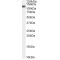 Ubiquitin Carboxyl-Terminal Hydrolase CYLD (Cyld) Antibody