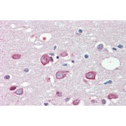 abx432193 (5 µg/ml staining of paraffin embedded Human Cortex. Steamed antigen retrieval with citrate buffer pH 6, AP-staining.