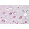 Myeloid/lymphoid Or Mixed-Lineage Leukemia Protein 4 (MLL4) Antibody