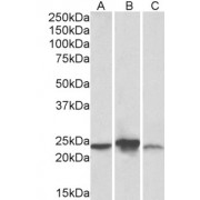 abx432201 (0.3 µg/ml) staining of Human (A), Mouse (B), Rat (C) Liver lysate (35 µg protein in RIPA buffer). Primary incubation was 1 hour. Detected by chemiluminescence.