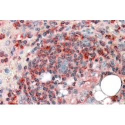 Actin Related Protein 2/3 Complex Subunit 2 (ARPC2) Antibody
