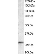abx432206 staining (1 µg/ml) of Human Lymph Node lysate (35 µg protein in RIPA buffer). Detected by chemiluminescence.
