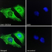 Immunofluorescence analysis of paraformaldehyde fixed HeLa cells, permeabilized with 0.15% Triton. Primary incubation 1hr (10 µg/ml) followed by Alexa Fluor 488 secondary antibody (2 µg/ml), showing vesicle and weak nuclear staining. The nuclear stain is DAPI (blue). Negative control: Unimmunized goat IgG (10 µg/ml) followed by Alexa Fluor 488 secondary antibody (2 µg/ml).