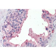 Immunohistochemistry analysis of paraffin-embedded Human Prostate using Steroid 5 Alpha Reductase 1 (SRD5A1) Antibody (3.75 µg/ml). Steamed antigen retrieval with citrate buffer pH 6, AP-staining.