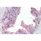Steroid 5 Alpha Reductase 1 (SRD5A1) Antibody