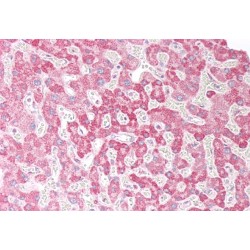 Oxysterol-Binding Protein-Related Protein 5 (OSBPL5) Antibody