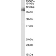 abx432217 (1 µg/ml) staining of HepG2 lysate (35 µg protein in RIPA buffer). Primary incubation was 1 hour. Detected by chemiluminescence.