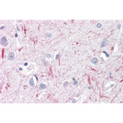 Deltex Homolog 3 (Drosophila) (DTX3) Antibody