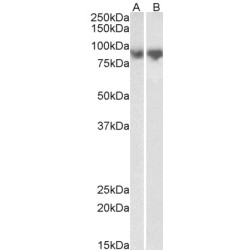 Cadherin-1 (CDH1) Antibody