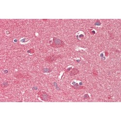 Carnitine O-Octanoyltransferase (Crot) Antibody